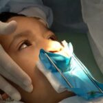 LEI GARANTE CIRURGIA E TRATAMENTO COMPLETO DE LÁBIO LEPORINO PELO SUS