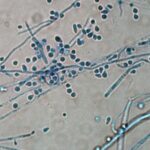 SUPERFUNGO RESISTENTE A TRATAMENTOS É IDENTIFICADO NO BRASIL